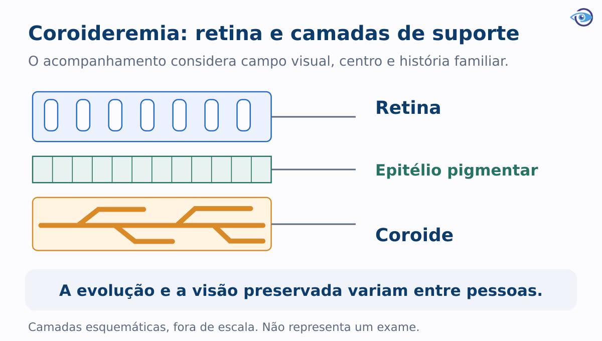 Corte educativo das camadas do fundo do olho, mostrando retina sensível à luz, epitélio pigmentar de suporte e coroide vascular. Ilustração fora de escala. Corte educativo das camadas do fundo do olho, mostrando retina sensível à luz, epitélio pigmentar de suporte e coroide vascular. Ilustração fora de escala.