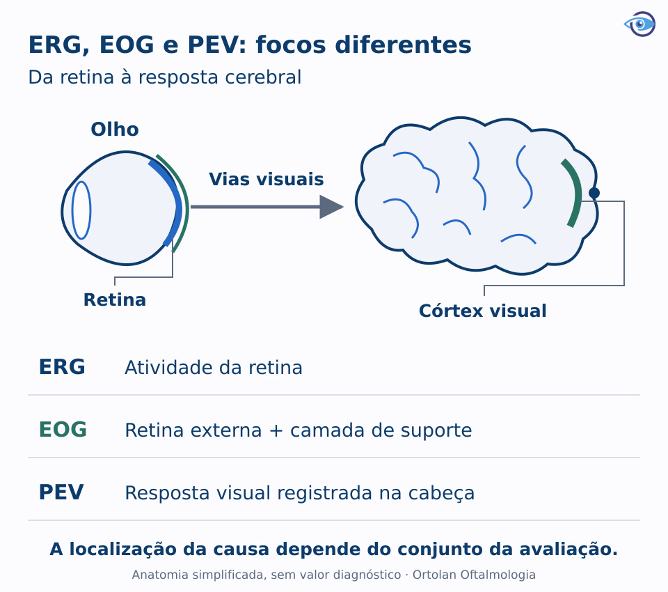 Esquema do olho e das vias visuais até o cérebro, indicando os diferentes focos do ERG, do EOG e do PEV, sem representar um exame real. Esquema do olho e das vias visuais até o cérebro, indicando os diferentes focos do ERG, do EOG e do PEV, sem representar um exame real.