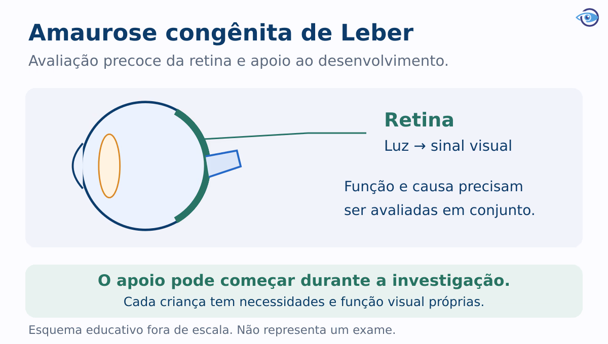 Esquema educativo localiza a retina no fundo do olho e relaciona sua função à avaliação visual, aos exames e ao apoio precoce ao desenvolvimento. Esquema educativo localiza a retina no fundo do olho e relaciona sua função à avaliação visual, aos exames e ao apoio precoce ao desenvolvimento.