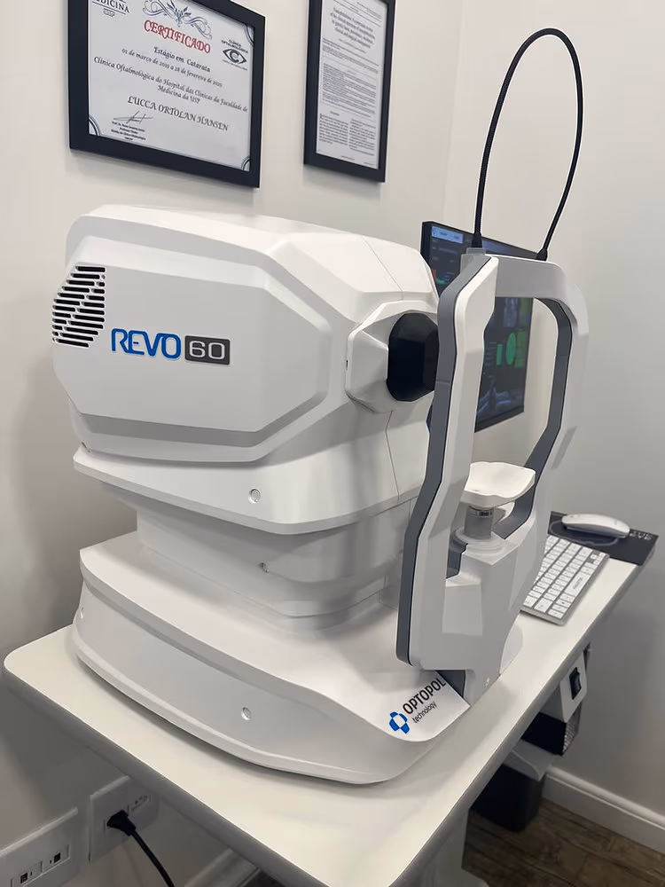 OCT REVO 60 da Optopol — equipamento de tomografia de coerência óptica da Ortolan Oftalmologia.