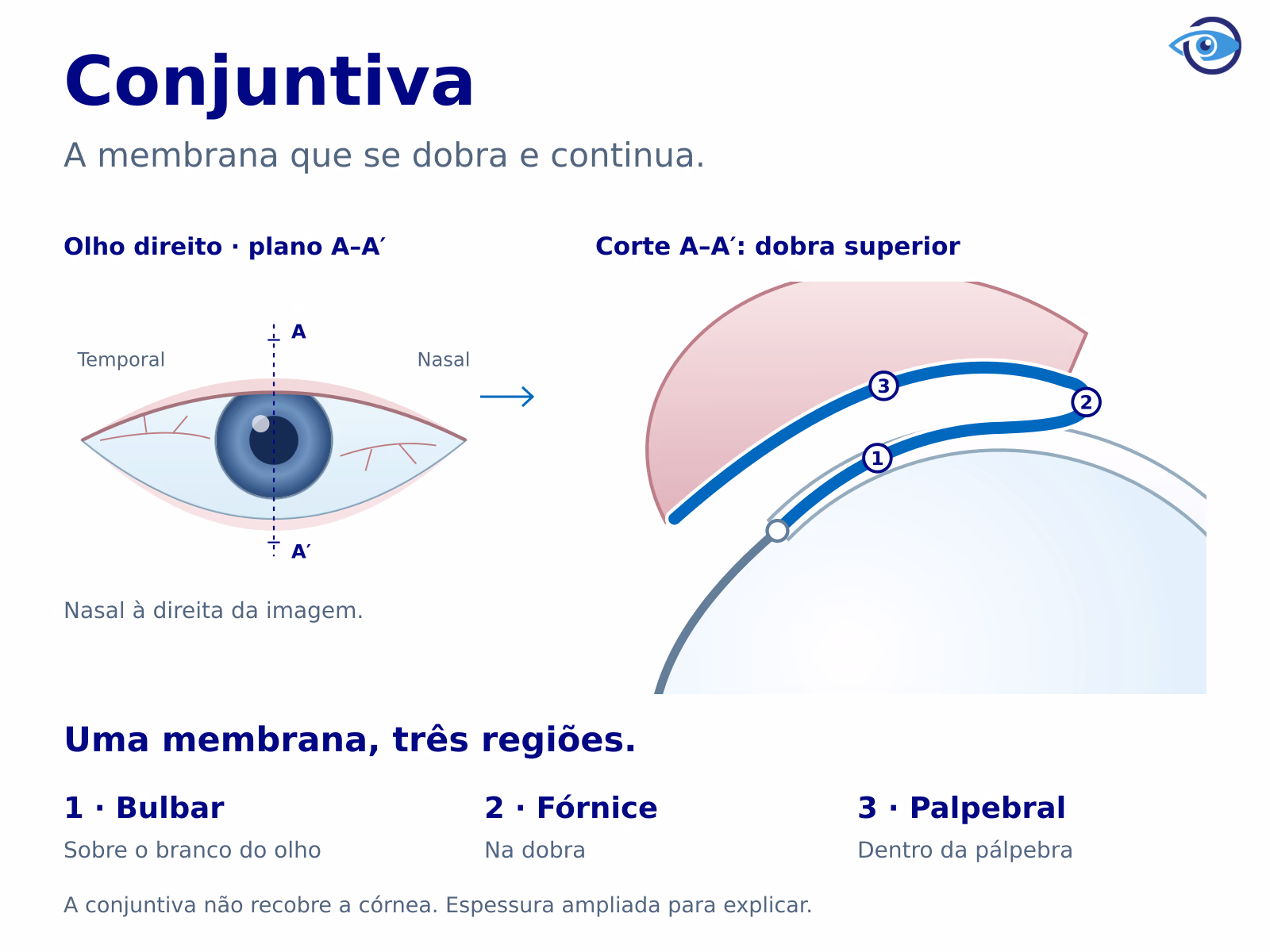 Olho direito de frente com um plano de corte marcado. O corte lateral e sua ampliação mostram uma membrana contínua sobre a esclera anterior, na dobra do fórnice e na face interna da pálpebra, sem recobrir a córnea. Olho direito de frente com um plano de corte marcado. O corte lateral e sua ampliação mostram uma membrana contínua sobre a esclera anterior, na dobra do fórnice e na face interna da pálpebra, sem recobrir a córnea.