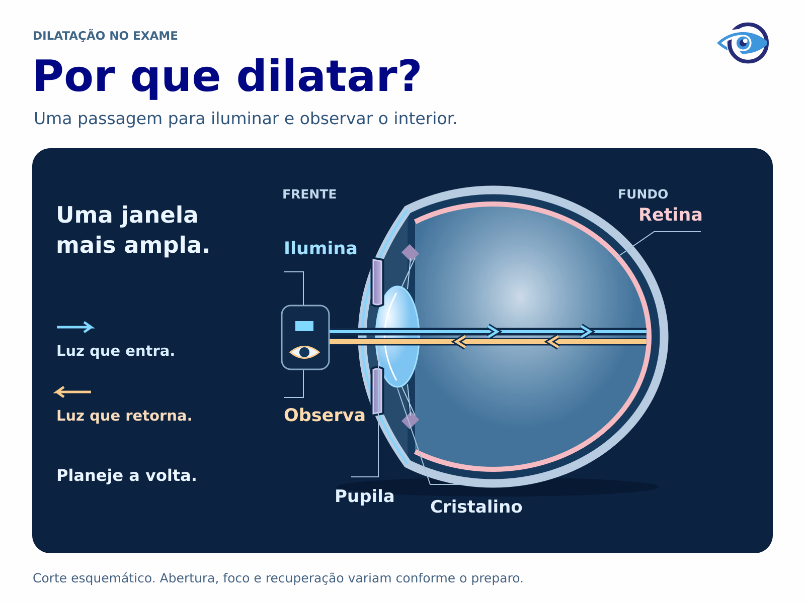 Ilustração original do olho em corte, com frente à esquerda e fundo à direita. Luz azul entra pela pupila; luz dourada retorna do fundo ao instrumento e ao observador. A abertura está ampliada. Os caminhos são conceituais, sem campo ou refração calculados. Ilustração original do olho em corte, com frente à esquerda e fundo à direita. Luz azul entra pela pupila; luz dourada retorna do fundo ao instrumento e ao observador. A abertura está ampliada. Os caminhos são conceituais, sem campo ou refração calculados.