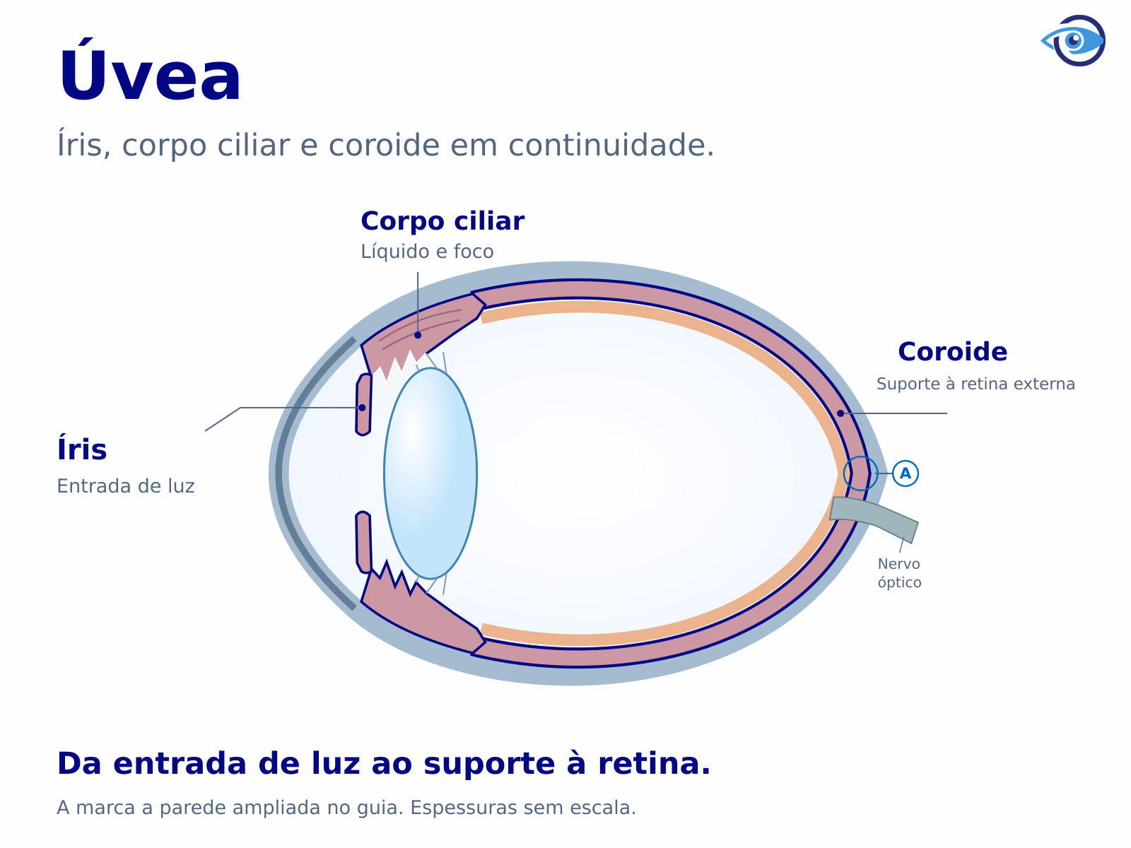Corte do olho com a frente à esquerda. Uma identificação contínua e chamadas ancoradas acompanham íris, corpo ciliar e coroide. Retina e cristalino ficam fora da úvea; o ponto A marca a parede posterior, ampliada no guia. Corte do olho com a frente à esquerda. Uma identificação contínua e chamadas ancoradas acompanham íris, corpo ciliar e coroide. Retina e cristalino ficam fora da úvea; o ponto A marca a parede posterior, ampliada no guia.