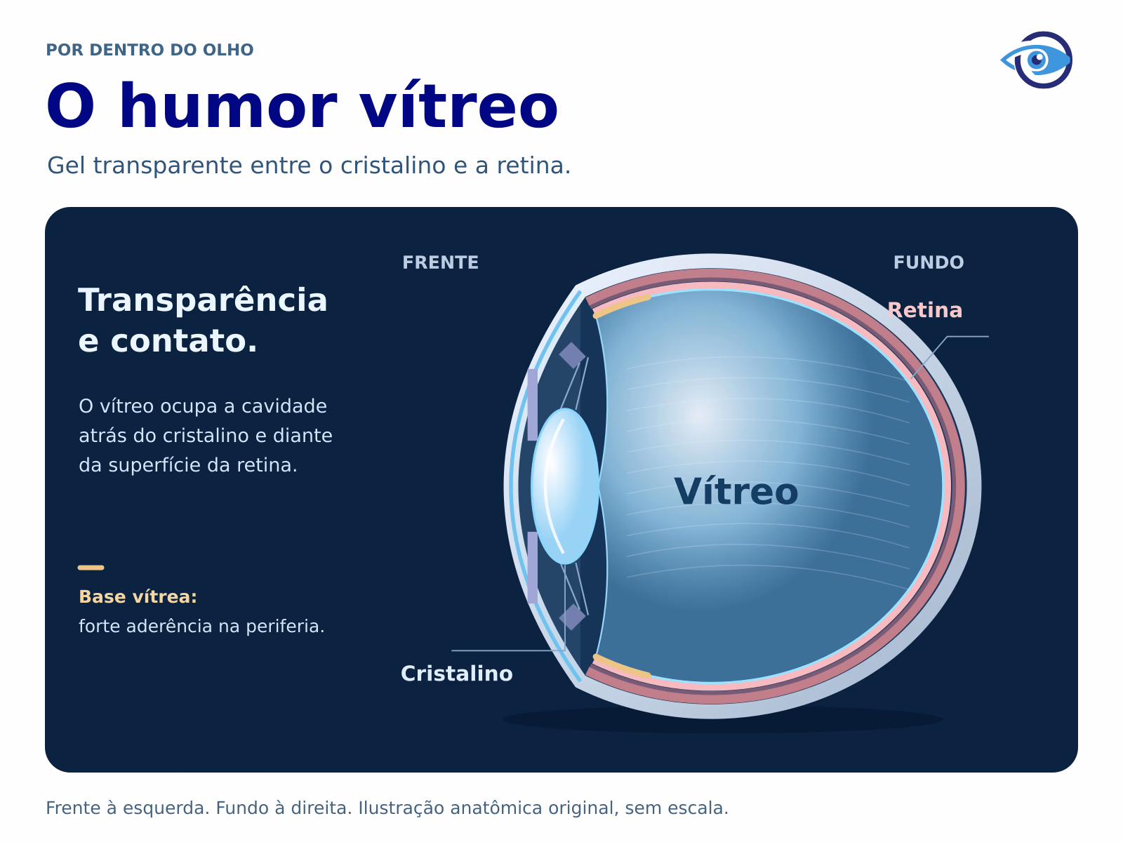 Corte anatômico original do olho, com a frente à esquerda e o fundo à direita. O vítreo transparente ocupa a cavidade atrás do cristalino e diante da retina. Marcas periféricas indicam a base vítrea, região de forte aderência. Corte anatômico original do olho, com a frente à esquerda e o fundo à direita. O vítreo transparente ocupa a cavidade atrás do cristalino e diante da retina. Marcas periféricas indicam a base vítrea, região de forte aderência.