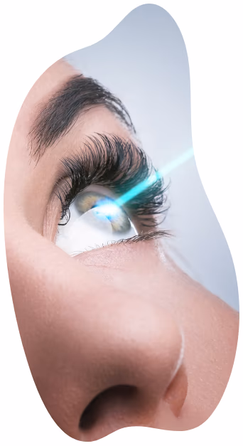 Ilustração das técnicas de cirurgia refrativa a laser.