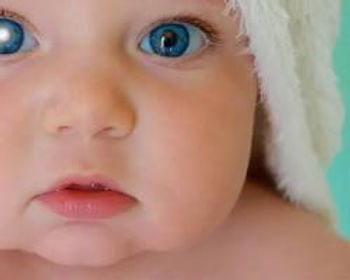 Catarata Congênita em um bebê.
