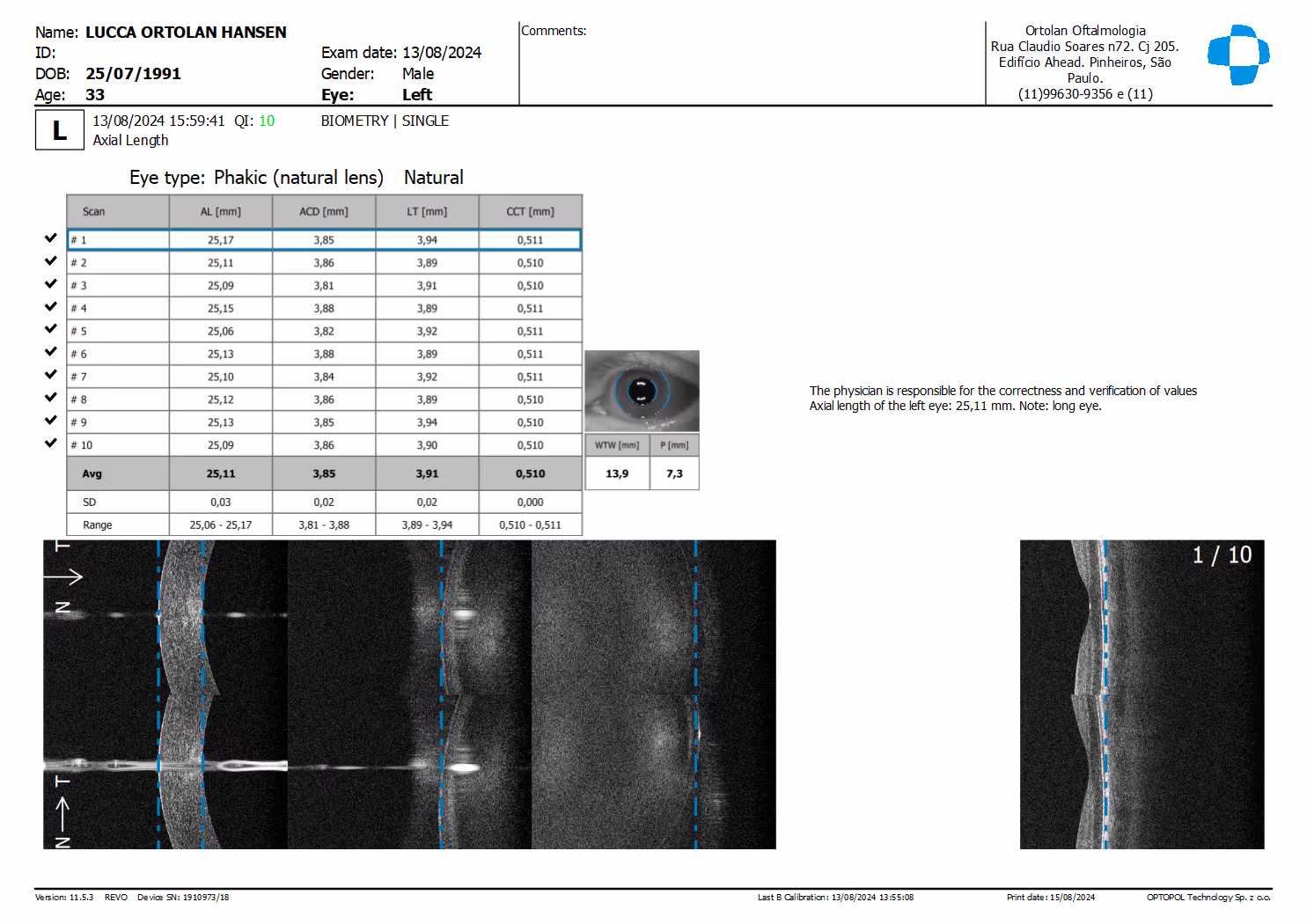 Imagem da página /exames/oct