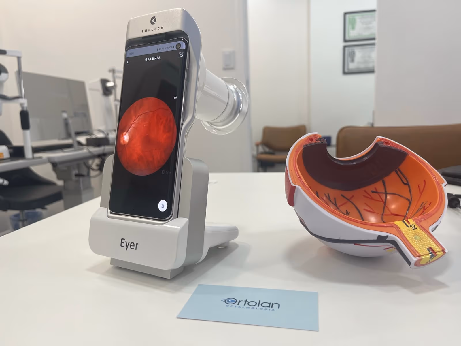 Imagem mostrando o Retinógrafo Eyer da Phelcom na Ortolan Oftalmologia - Unidade Faria Lima. Ao lado há um modelo de olho esquemático para explicação didática dos achados do exame do fundo do olho. Nota-se um cartão da clínica Ortolan Oftalmologia na mesa ao lado do Retinógrafo Eyer.