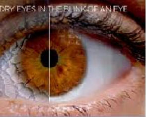 Olho Seco causa piora do quadro.