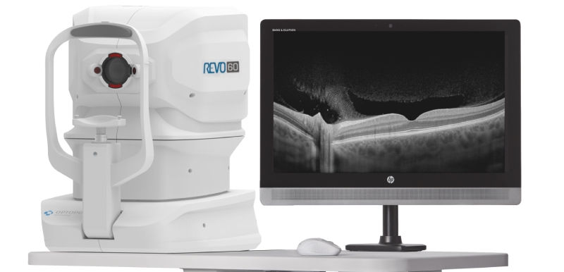 Imagem da página /exames/oct