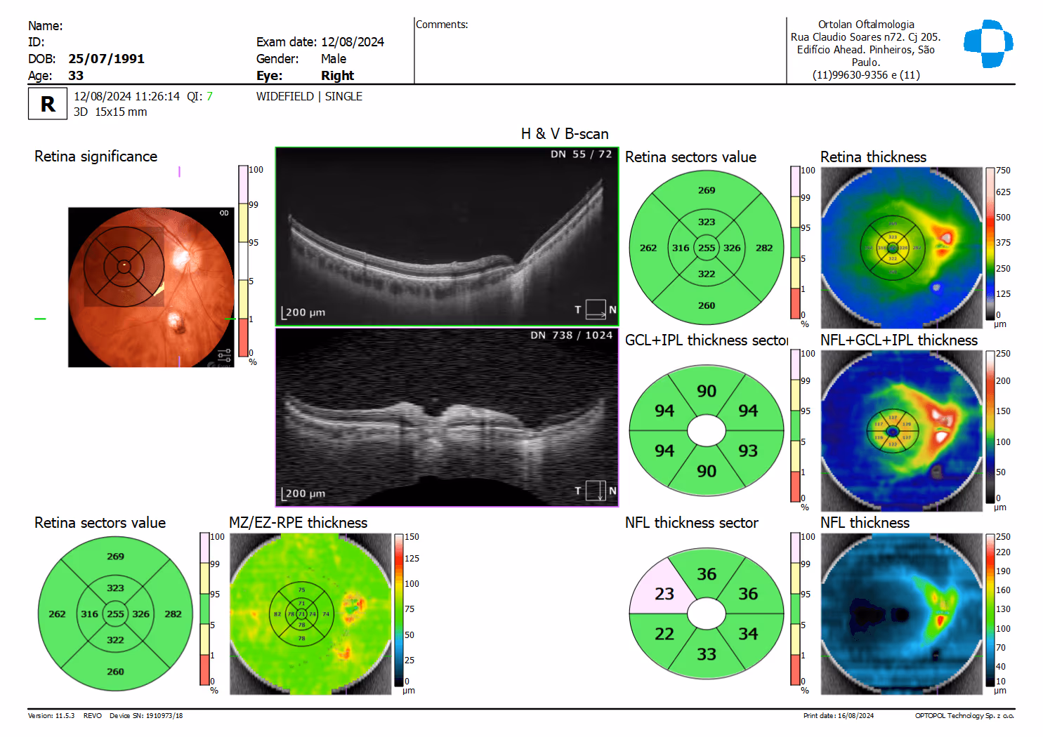 Imagem da página /exames/oct