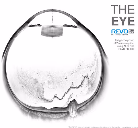 Imagem da página /exames/oct