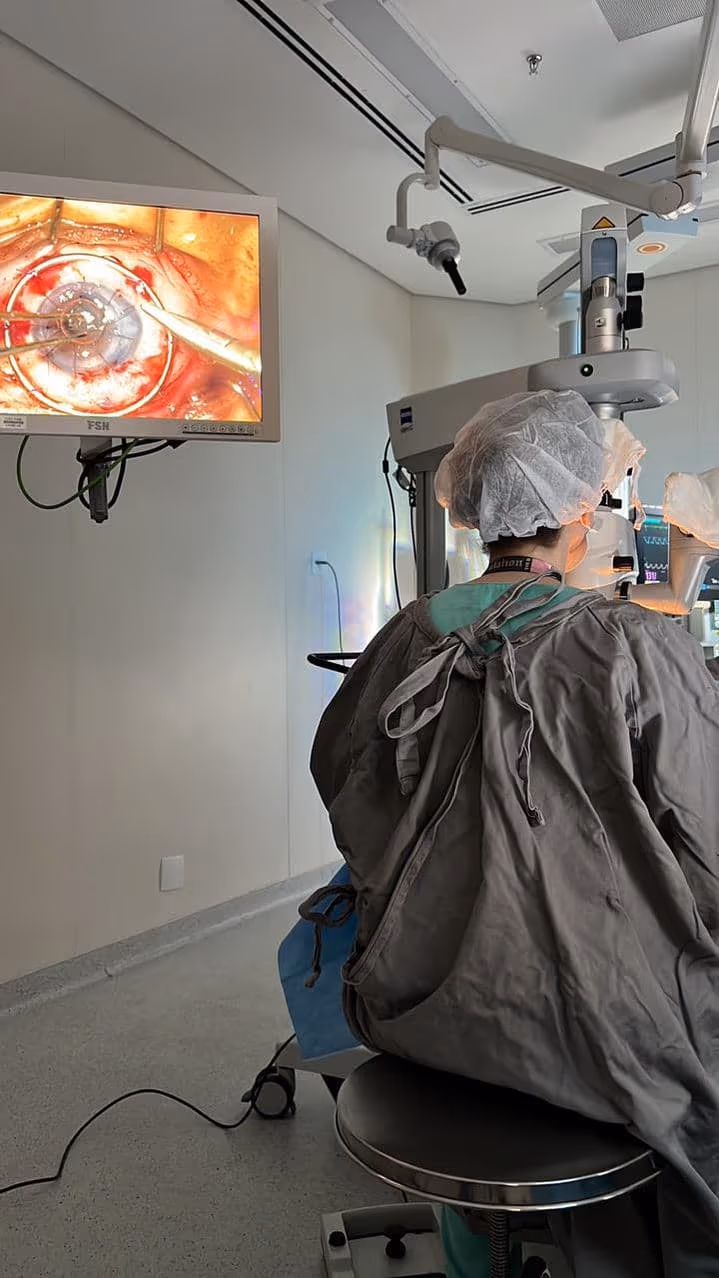 Dra. Nicole Bulgarão realizando transplante endotelial de córnea (DMEK) — técnica avançada