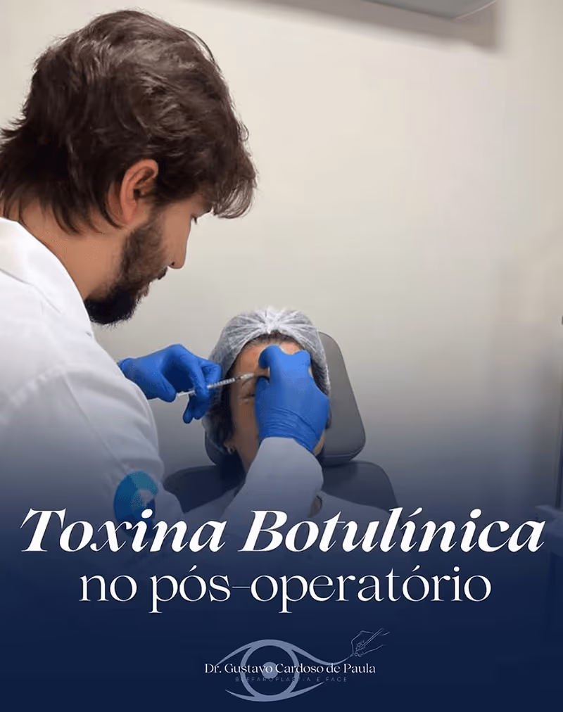 Dr. Gustavo de Paula realiza procedimentos de toxina botulínica e preenchedores com bioestimuladores