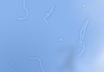 Moscas volantes na visão do paciente que está olhando para o céu azul. As moscas volantes são manchas pequenas e móveis na visão. As moscas volantes podem estar associadas ao descolamento do vítreo posterior (DVP) ou ao descolamento de retina. Deve-se realizar mapeamento de retina em pacientes com casos novos de moscas volantes, aumento do número de moscas, ou moscas volantes associadas à flashes de luz (fotopsias). Estes são sinais de risco de descolamento de retina regmatogênico.