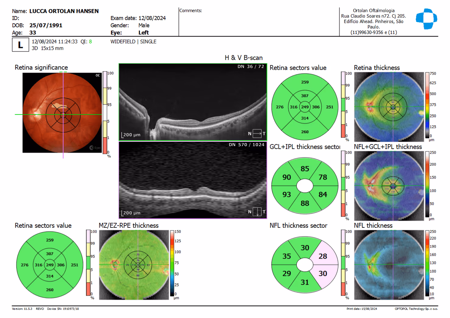 Imagem da página /exames/oct