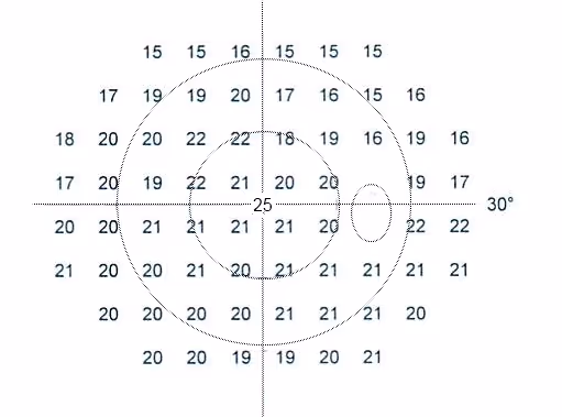 Exame de campo visual (campimetria central 30°).